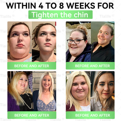 Official Store | 𝗧𝗹𝗮𝐥𝐢𝐟𝐞® 𝐆𝐋𝐏-𝟏 𝐒𝐮𝐩𝐞𝐫 𝐏𝐫𝐨𝐛𝐢𝐨𝐭𝐢𝐜 𝐅𝐥𝐨𝐫𝐚 𝑶𝒓𝒂𝒍 𝑺𝒐𝒍𝒖𝒕𝒊𝒐𝒏(𝑂𝑛𝑐𝑒 𝑎 𝑑𝑎𝑦, 𝑣𝑖𝑠𝑖𝑏𝑙𝑒 𝑟𝑒𝑠𝑢𝑙𝑡𝑠 𝑖𝑛 7 𝑑𝑎𝑦𝑠) ✅ 𝗦𝘂𝗽𝗽𝗼𝗿𝘁𝘀 𝗼𝗯𝗲𝘀𝗶𝘁𝘆, 𝗰𝗮𝗿𝗱𝗶𝗼𝘃𝗮𝘀𝗰𝘂𝗹𝗮𝗿 𝗵𝗲𝗮𝗹𝘁𝗵, 𝗱𝗶𝗮𝗯𝗲𝘁𝗲𝘀, 𝘀𝗹𝗲𝗲𝗽 𝗮𝗽𝗻𝗲𝗮, 𝗴𝘂𝘁 𝗵𝗲𝗮𝗹𝘁𝗵, 𝗷𝗼𝗶𝗻𝘁 𝗶𝘀𝘀𝘂𝗲𝘀, 𝐰𝐡𝐢𝐥𝐞 𝐚𝐥𝐬𝐨 𝐟𝐢𝐫𝐦𝐢𝐧𝐠 𝐭𝐡𝐞 𝐬𝐤𝐢𝐧 𝐚𝐧𝐝 𝐛𝐨𝐨𝐬𝐭𝐢𝐧𝐠 𝐞𝐧𝐞𝐫𝐠𝐲.