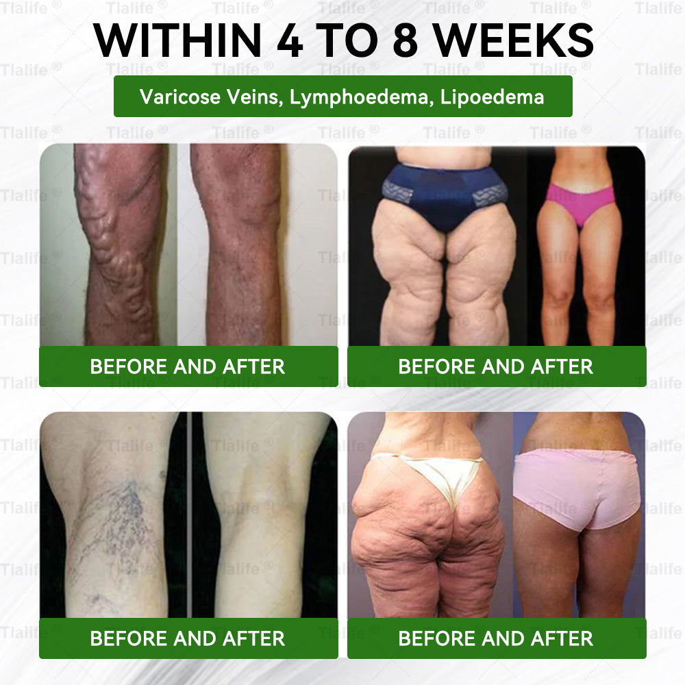 ⏰ Low Stock Alert! You now have an exclusive 30% discount — grab it before it sells out! Add it to your order right now ⏰ 𝗧𝗹𝗮𝐥𝐢𝐟𝐞®