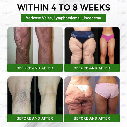 ⏰ Low Stock Alert! You now have an exclusive 30% discount — grab it before it sells out! Add it to your order right now ⏰ 𝗧𝗹𝗮𝐥𝐢𝐟𝐞®